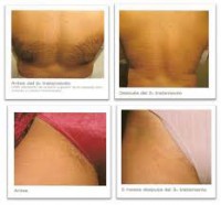 /album/tipsdedepilacionperlayale/images-21-jpg/